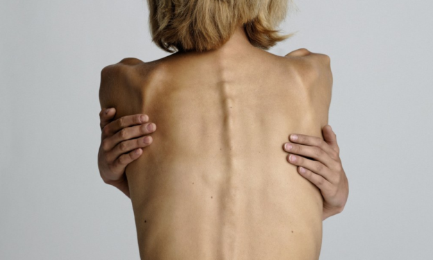 skinny woman